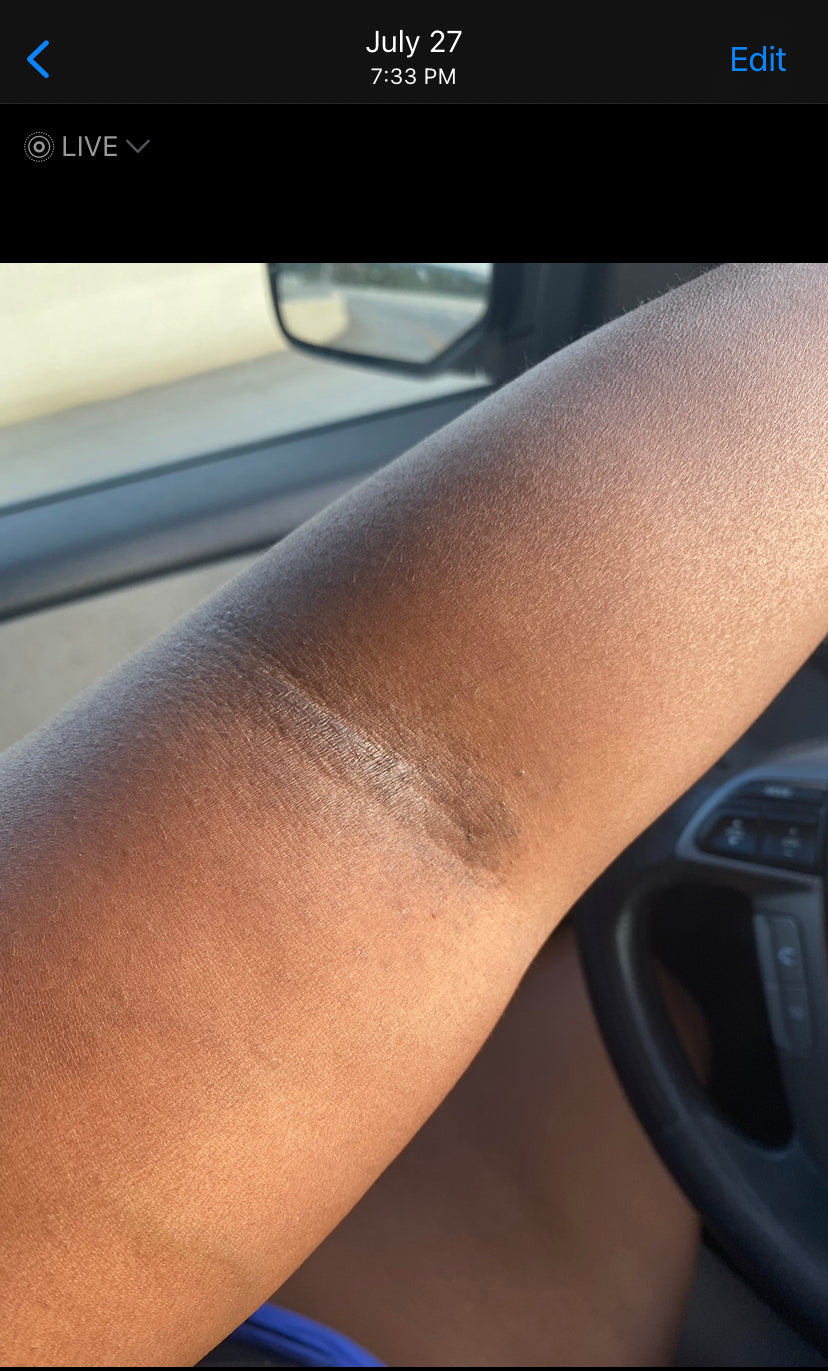 Organic Blemish Butter - 8oz