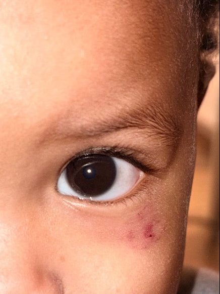 Organic Blemish Butter - 8oz